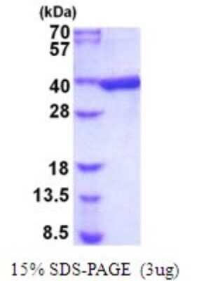 SDS-PAGE: Recombinant Mouse AKR1B1 His Protein [NBP2-51989]