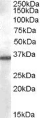 Western Blot: Aldo-keto Reductase 1B10/AKR1B10 Antibody [NB100-93370]