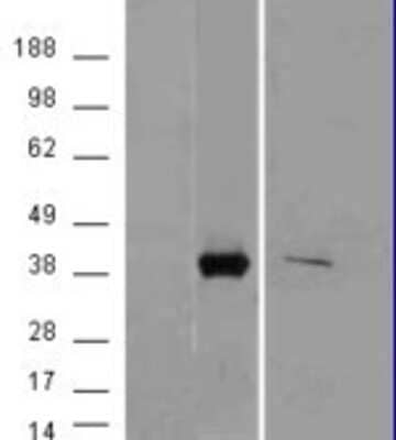 Western Blot: Aldo-keto Reductase 1B10/AKR1B10 Antibody [NB100-93370]