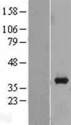 Western Blot: Aldo-keto Reductase 1B10/AKR1B10 Overexpression Lysate [NBL1-07434]