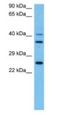 Western Blot: AKR1C13 Antibody [NBP3-10173]