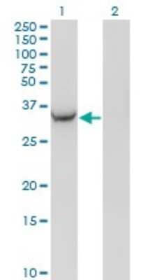 Western Blot: AKR1C2 Antibody (3C11) [H00001646-M03]