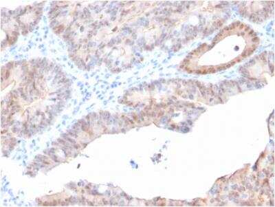 Immunohistochemistry-Paraffin: AKR1C2 Antibody (CPTC-AKR1C2-1) - Azide and BSA Free [NBP2-79909]