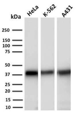 Western Blot: AKR1C2 Antibody (CPTC-AKR1C2-1)Azide and BSA Free [NBP2-79909]