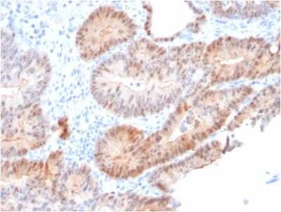 Immunohistochemistry-Paraffin: AKR1C2 Antibody (CPTC-AKR1C2-1) [NBP2-79775]