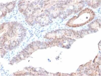 Immunohistochemistry-Paraffin: AKR1C2 Antibody (CPTC-AKR1C2-1) [NBP2-79775]