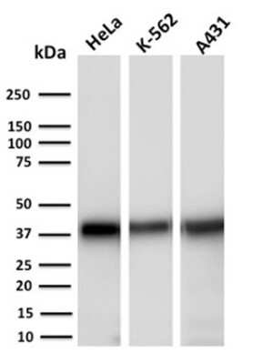 Western Blot: AKR1C2 Antibody (CPTC-AKR1C2-1) [NBP2-79775]