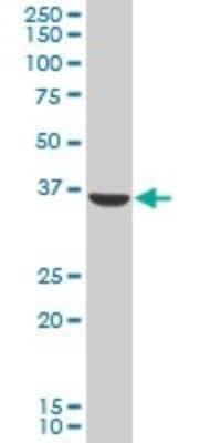 Western Blot: AKR1C2 Antibody [H00001646-B02P]