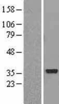 Western Blot: AKR1C2 Overexpression Lysate [NBL1-07435]