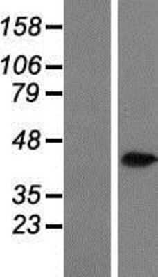 Western Blot: Aldo-keto Reductase 1C3/AKR1C3 Overexpression Lysate [NBP2-07959]