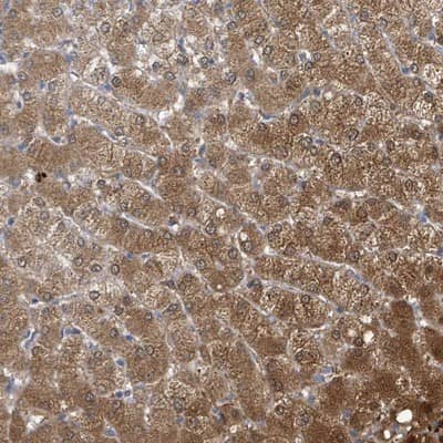 Immunohistochemistry-Paraffin: Aldo-keto Reductase 1C4/AKR1C4 Antibody [NBP2-14277]