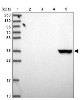 Western Blot: Aldo-keto Reductase 1C4/AKR1C4 Antibody [NBP2-14277]