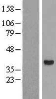 Western Blot: Aldo-keto Reductase 1C4/AKR1C4 Overexpression Lysate [NBL1-07437]