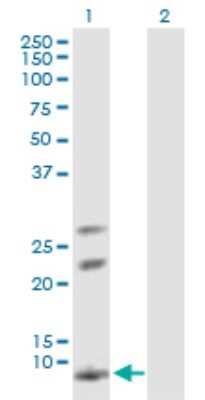 Western Blot: AKR1CL1 Antibody [H00340811-B01P]