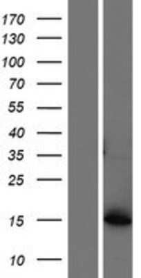 Western Blot: AKR1CL1 Overexpression Lysate [NBP2-08817]