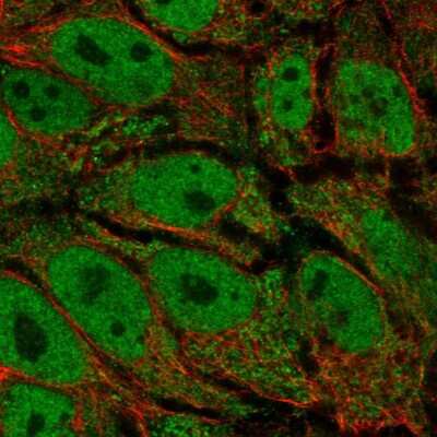 Immunocytochemistry/ Immunofluorescence: AKR1CL2 Antibody [NBP2-55163]