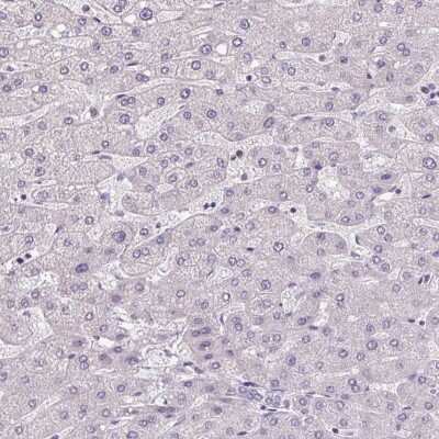 Immunohistochemistry-Paraffin: AKR1CL2 Antibody [NBP1-90195]