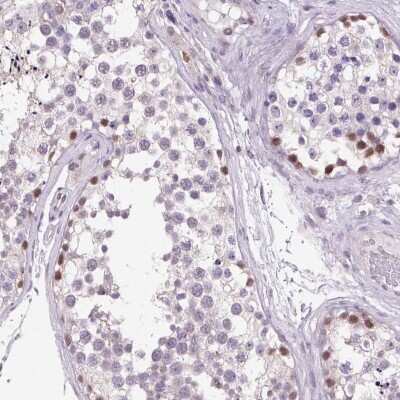 Immunohistochemistry-Paraffin: AKR1CL2 Antibody [NBP1-90195]
