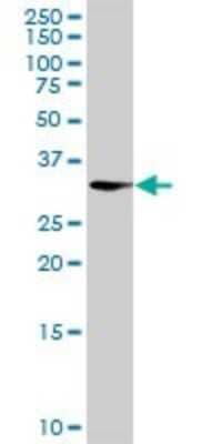 Western Blot: AKR1CL2 Antibody [H00083592-B01P]