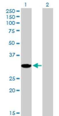 Western Blot: AKR1CL2 Antibody [H00083592-B01P]
