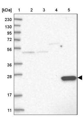 Western Blot: AKR1CL2 Antibody [NBP1-90195]