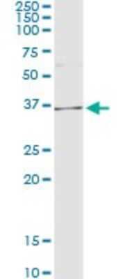 Immunoprecipitation: AKR1D1 Antibody (1A6) [H00006718-M01]