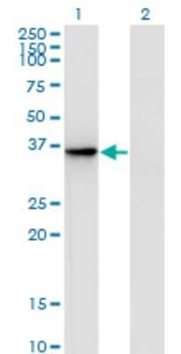 Western Blot: AKR1D1 Antibody (1A6) [H00006718-M01]