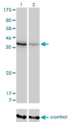 Western Blot: AKR1D1 Antibody (1C2) [H00006718-M03]