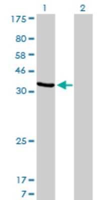 Western Blot: AKR1D1 Antibody (1C2) [H00006718-M03]