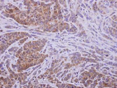 Immunohistochemistry-Paraffin: AKR1D1 Antibody [NBP2-15323]