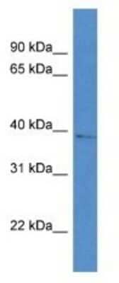 Western Blot: AKR1D1 Antibody [NBP1-74082]