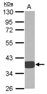 Western Blot: AKR1D1 Antibody [NBP2-15323]