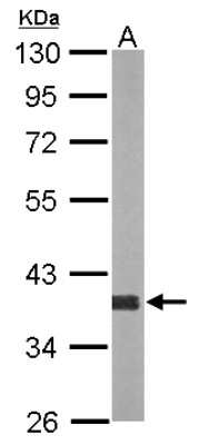 Western Blot: AKR1D1 Antibody [NBP2-21603]
