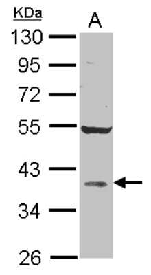 Western Blot: AKR1D1 Antibody [NBP2-21603]