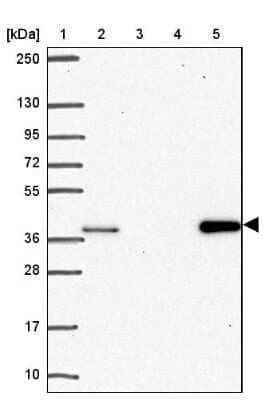 Western Blot: AKR1D1 Antibody [NBP2-33811]