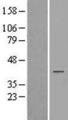 Western Blot: AKR1D1 Overexpression Lysate [NBL1-07438]