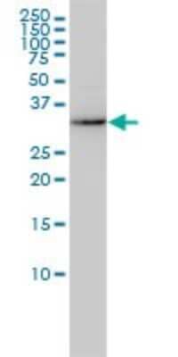 Western Blot: AKR7A2 Antibody (2A6) [H00008574-M01]