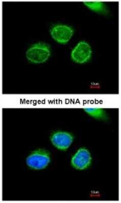 Immunocytochemistry/ Immunofluorescence: AKR7A2 Antibody [NBP1-32828]
