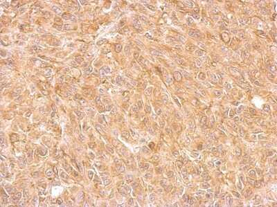 Immunohistochemistry-Paraffin: AKR7A2 Antibody [NBP1-32828]