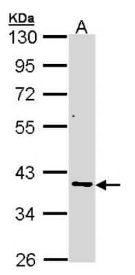 Western Blot: AKR7A2 Antibody [NBP1-32828]