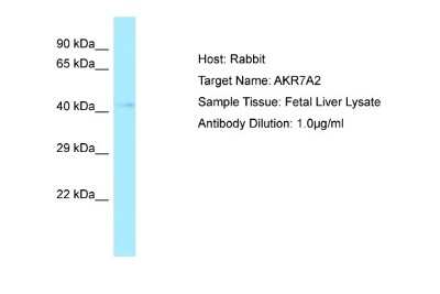 Western Blot: AKR7A2 Antibody [NBP1-98519]