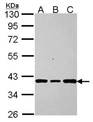 Western Blot: AKR7A2 Antibody [NBP2-15325]