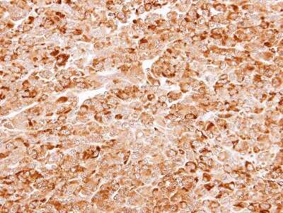 Immunohistochemistry-Paraffin: AKR7A3 Antibody [NBP1-31614]