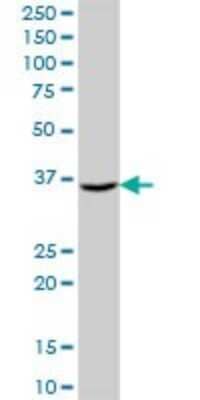 Western Blot: AKR7A3 Antibody [H00022977-B01P]