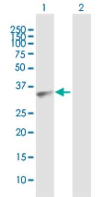 Western Blot: AKR7A3 Antibody [H00022977-B01P]