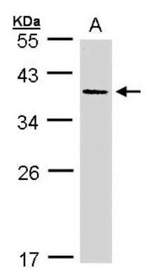 Western Blot: AKR7A3 Antibody [NBP1-31614]