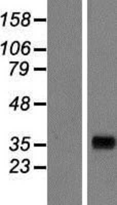 Western Blot: AKR7A3 Overexpression Lysate [NBP2-07498]