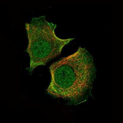 Immunocytochemistry/ Immunofluorescence: AKT1 Antibody (CL0887) [NBP2-52956]