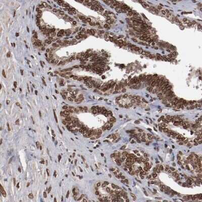 Immunohistochemistry-Paraffin: AKT1 Antibody [NBP1-89159]