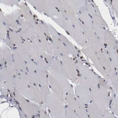 Immunohistochemistry-Paraffin: AKT1 Antibody [NBP1-89159]